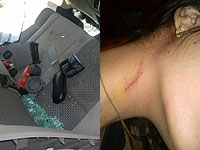 При поиске наркотиков полицейские в штатском травмировали 26-летнюю Маргариту Шульман. ФОТО