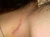 Депутат Светлова: МАХАШ должен расследовать травмирование Маргариты Шульман