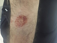 Четверо постояльцев гостиницы на Мертвом море покусали полицейских