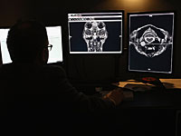 Рентгентехники ужесточают борьбу за свои права. Список больниц, участвующих в забастовке