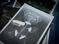 Суд обязал рентгентехников временно прекратить забастовку