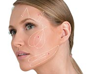 Нитевая подтяжка кожи лица – комфортное и безболезненное омоложение 