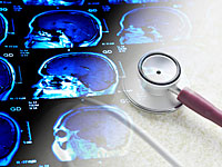 БАГАЦ не смог решить, является ли ущерб, причиненный мозгу Махмуда Алаана, необратимым