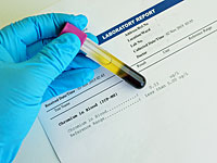 Исследование: биодобавки с хромом могут повышать риск развития рака