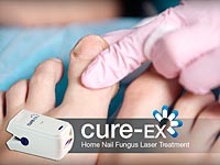 Израильский антигрибковый прибор привлек внимание ведущих дерматологов мира
