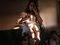 Ученые обнаружили связь между вирусом Зика и поражением мозга взрослых людей