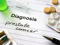 Исследование: подавление тестостерона при лечении рака простаты может вызвать слабоумие