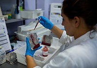 Американские ученые обнаружили антитело, нейтрализующее вирус Зика