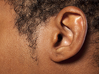 Китайские хирурги вырастили ухо в тканях руки пациента