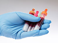 Минздрав Турции подтвердил, что в Идлибе был использован отравляющий газ зарин