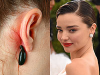 Звезды рекомендуют пиявки для омоложения и вагинальную баню для усиления сексуальности