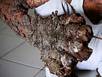 Израильские врачи дали надежду 