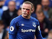 Окровавленный Руни. Испанцы