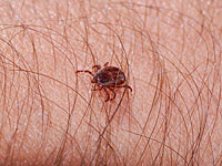 15-летний израильтянин заразился клещевым сыпным тифом от своей собаки