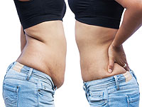 Стройное тело: избавление от лишнего жира за один сеанс –  навсегда