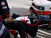 Фотожурналист Ефимович: на террористе, раненном военными, было устройство, похожее на