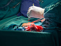 Израильские врачи провели операцию на сердце малыша из Сирии